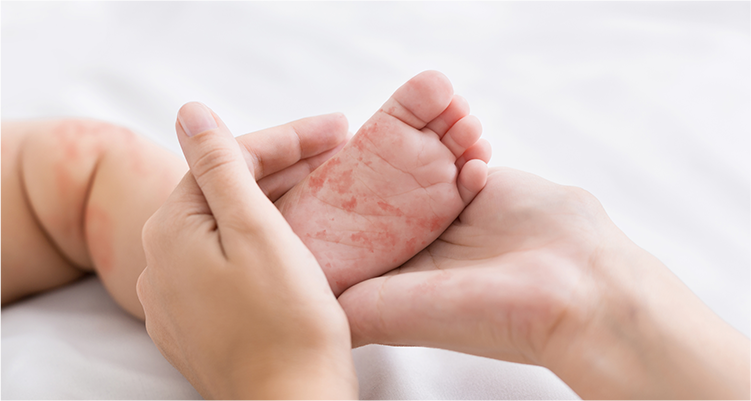 小さいお子さんから大人まで幅広い皮膚疾患に対応